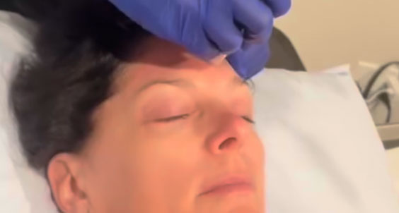Natural-Looking-Results,-Always