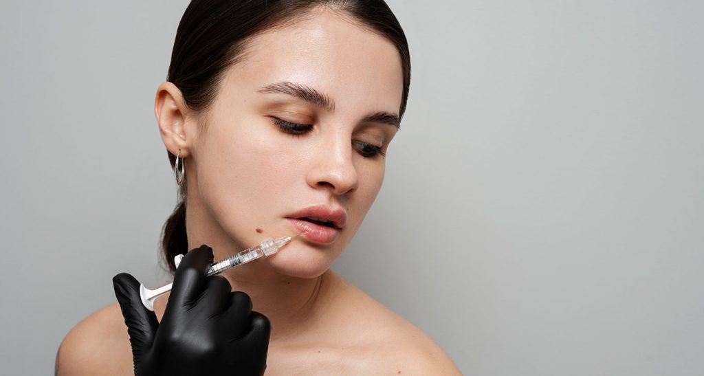 Top 3 Reasons Lip Filler Looks Overdone and How to Avoid Them